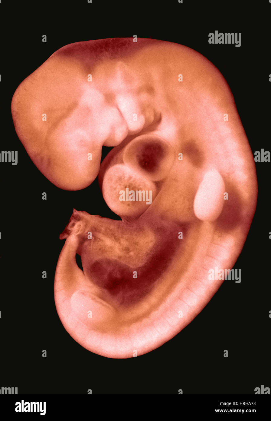 30 day old human embryo Stock Photo