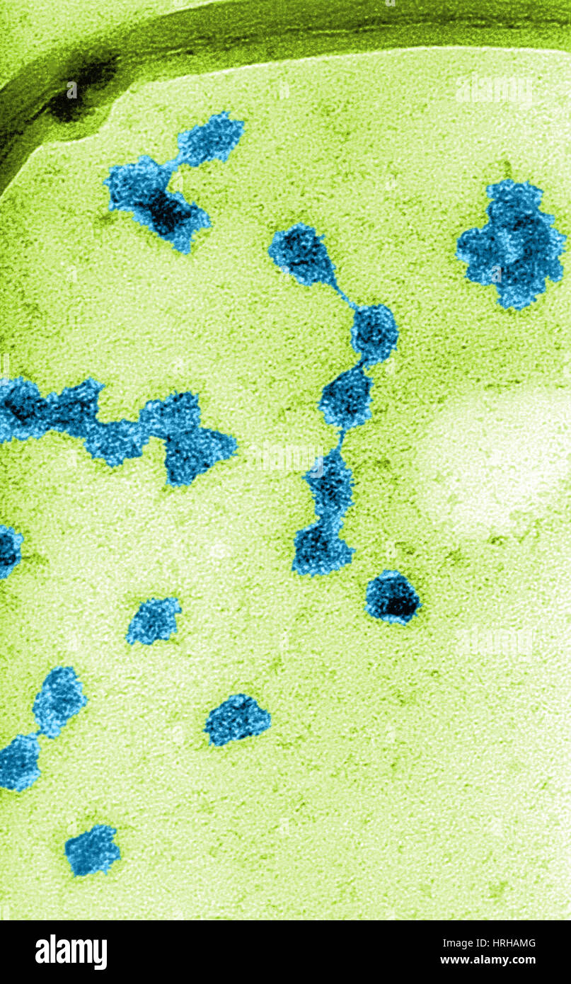 Ribosome electron micrograph hi-res stock photography and images - Alamy