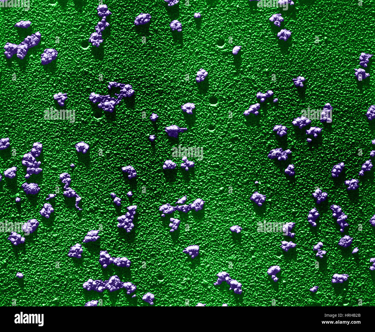 Ribosome electron micrograph hi-res stock photography and images - Alamy