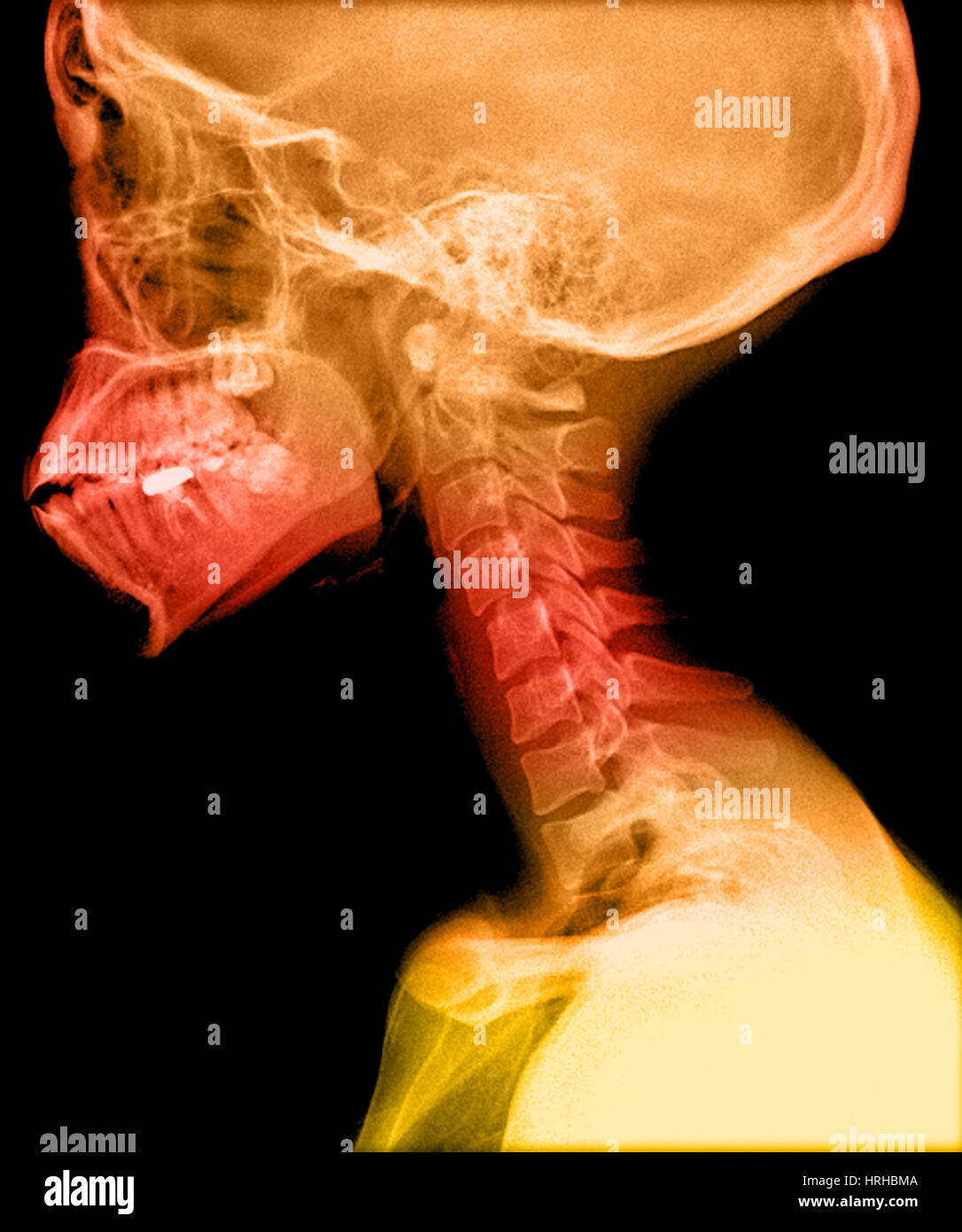Human skull and cervical spine hi-res stock photography and images - Alamy