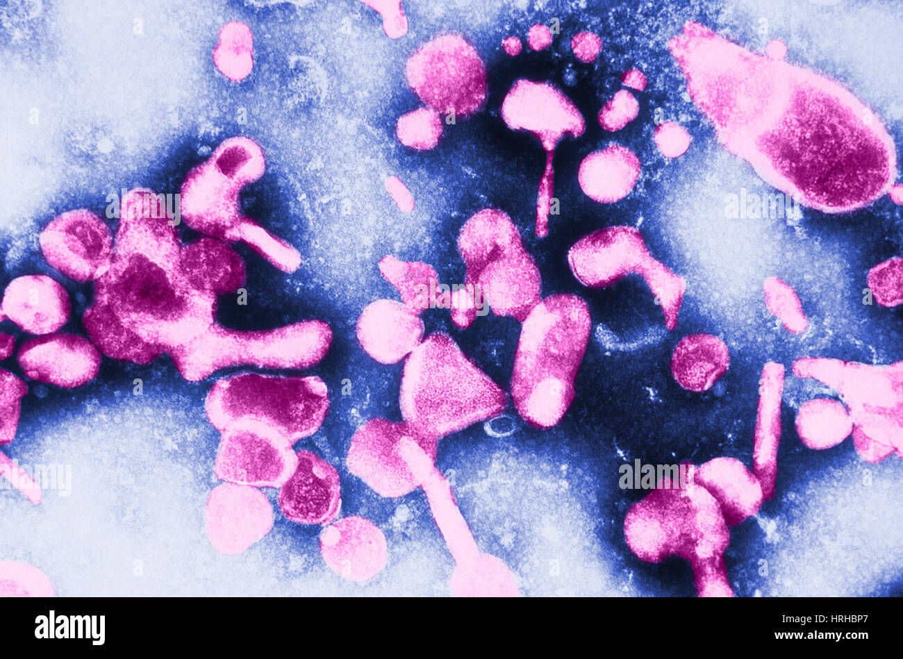 Curated visual reference: Picture Idea: Tem Of Feline Leukemia Virus Stock Photo