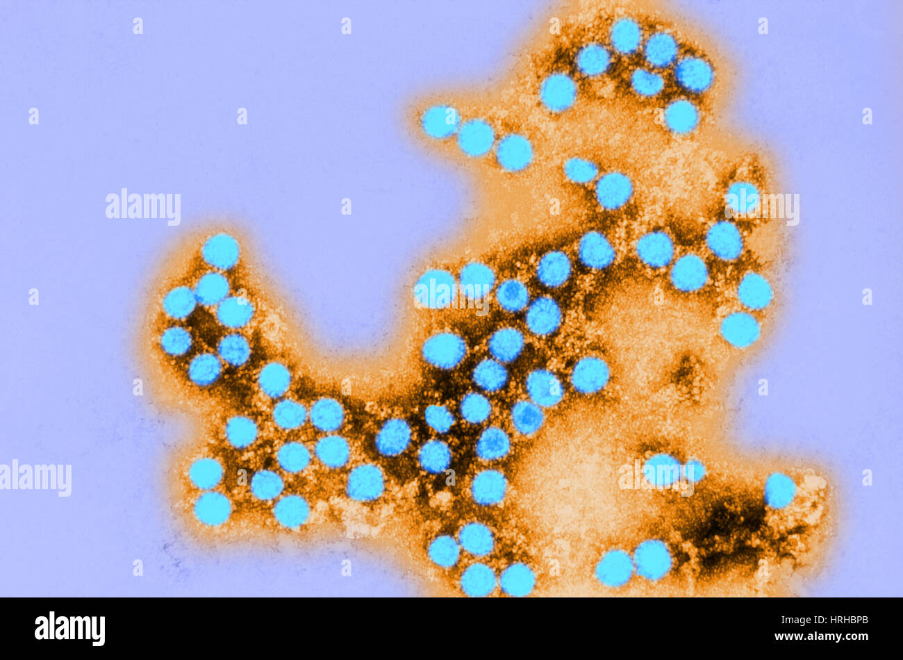 Coxsackie Virus Stock Photos & Coxsackie Virus Stock Images Alamy