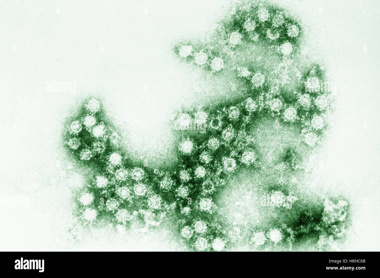 Coxsackie virus hires stock photography and images Alamy