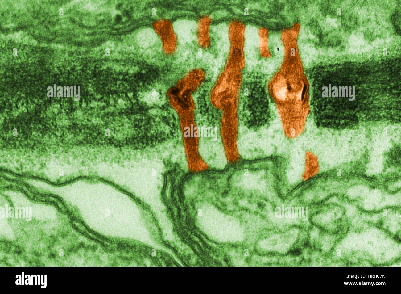 Plasmodesmata TEM Stock Photo