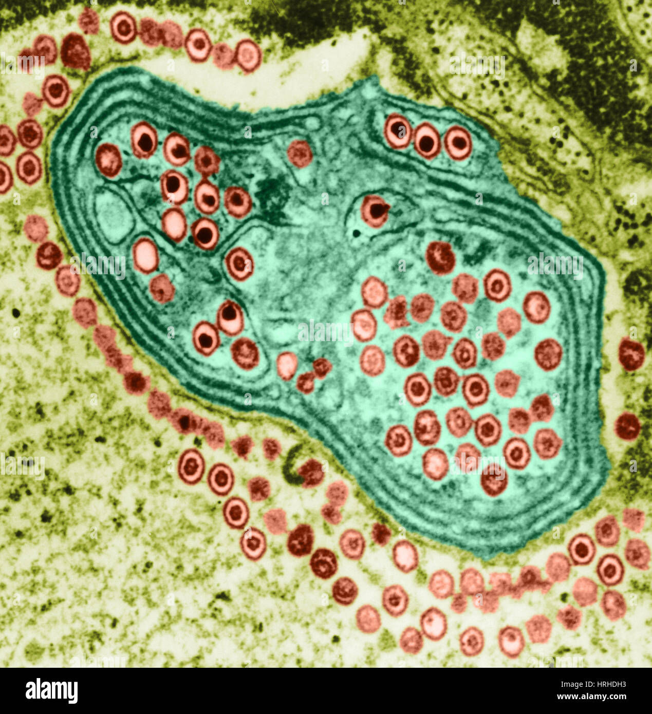 Herpes Simplex Virus, TEM Stock Photo