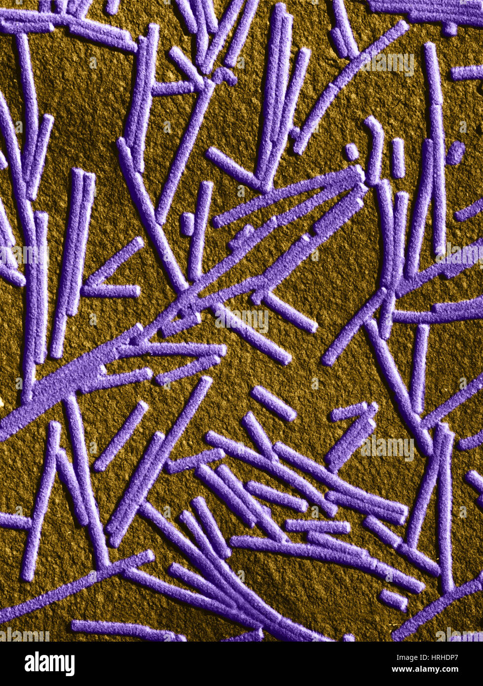 Tobacco Mosaic Virus Under Microscope