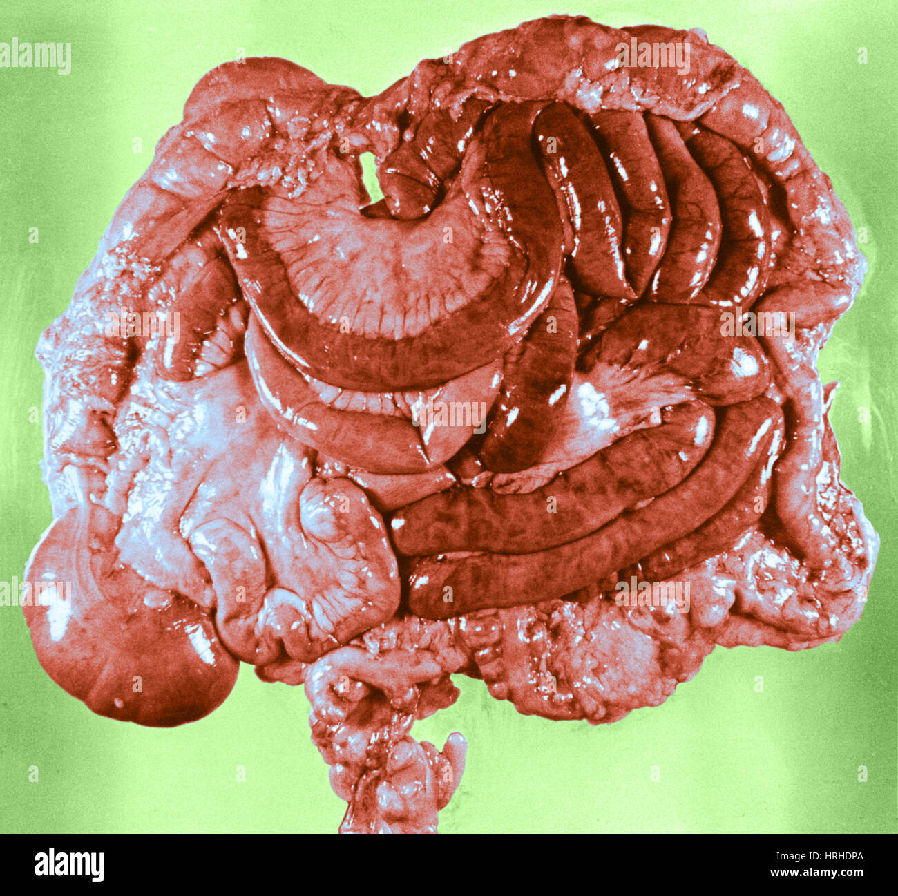 Mesentery High Resolution Stock Photography and Images - Alamy
