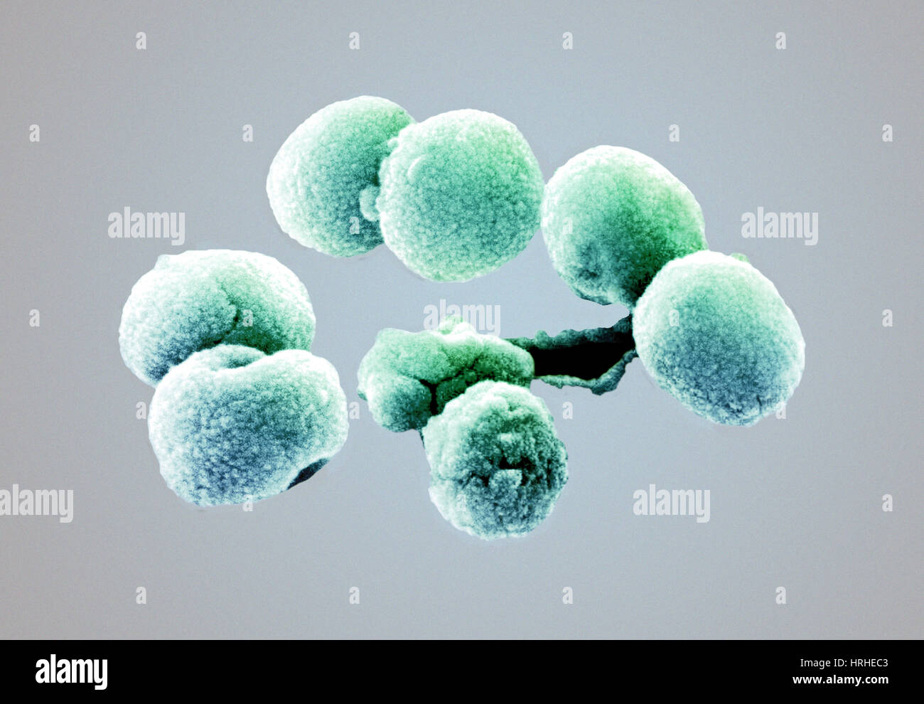 Streptococcus pneumoniae scanning hi-res stock photography and images ...