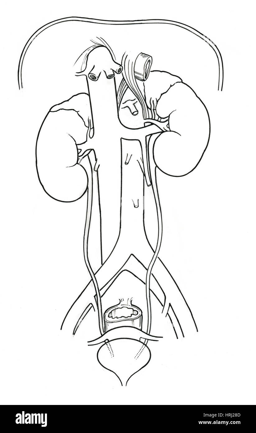 Illustration of Female Urinary System Stock Photo Alamy