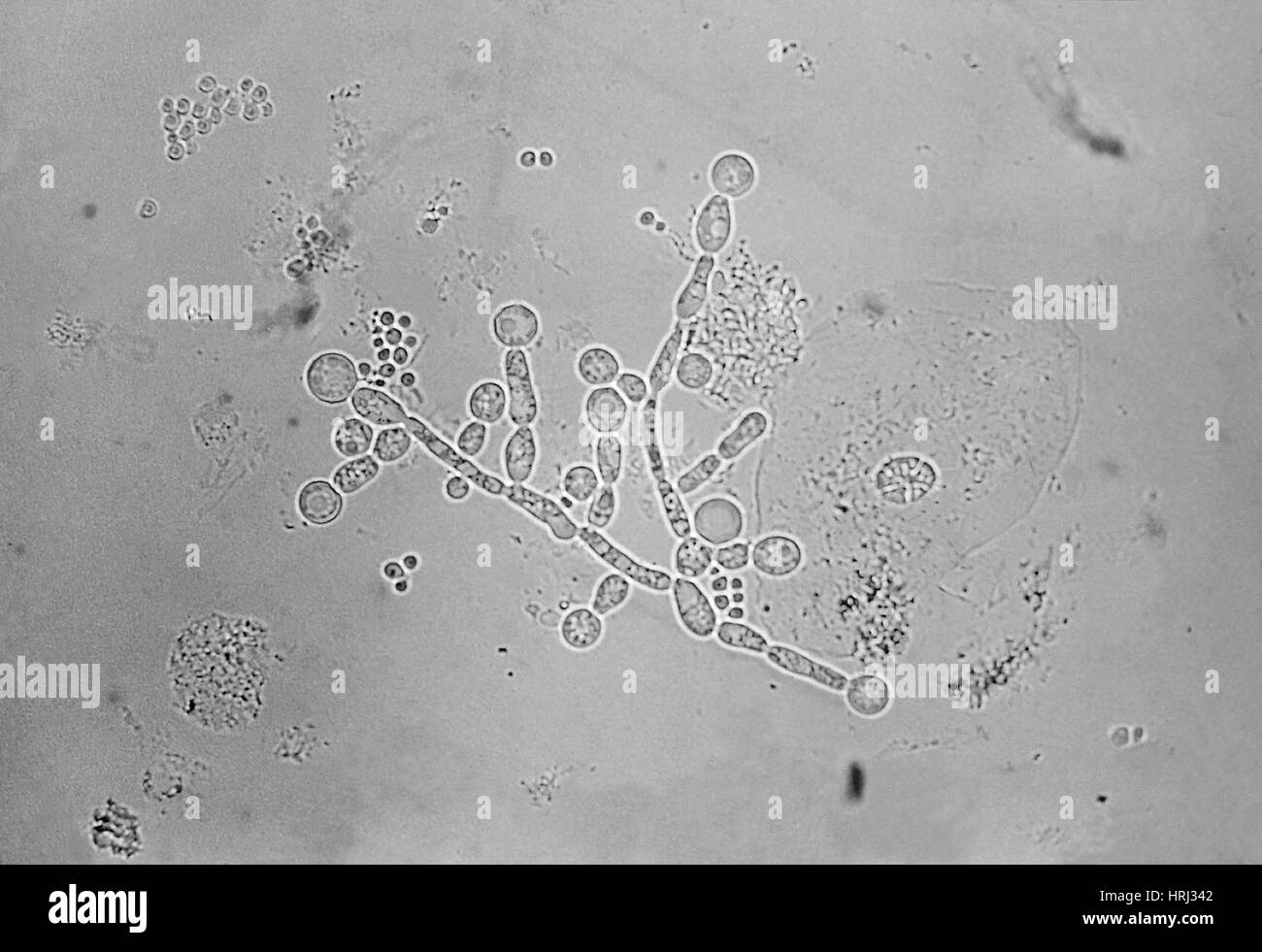 Candida albicans micrograph hi-res stock photography and images - Alamy