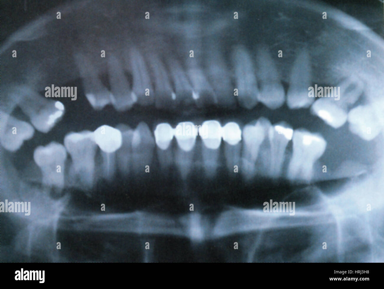 Panoramic Dental XRay Stock Photo Alamy