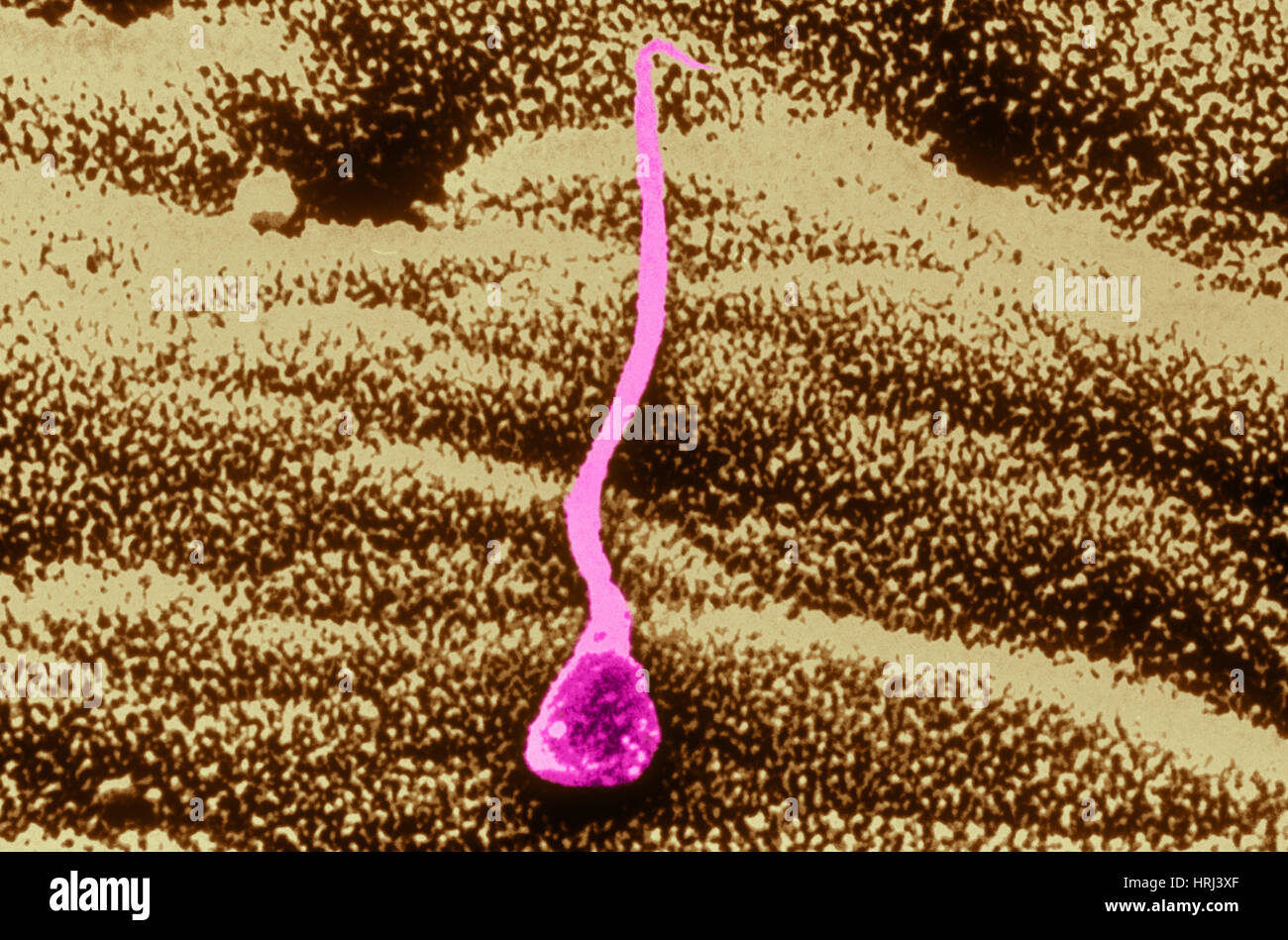 Human sperm in uterus Stock Photo
