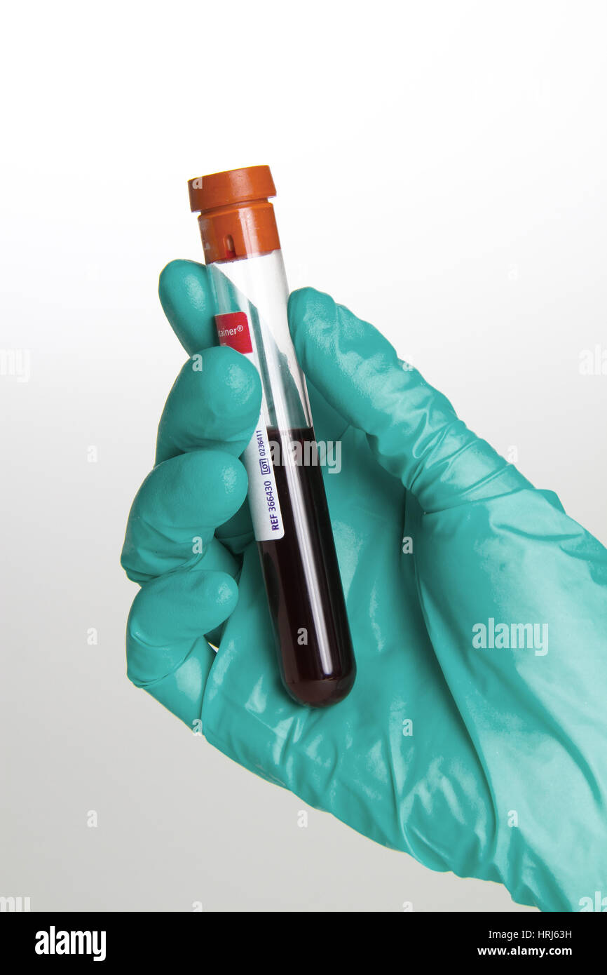 Blood samples testing screening hires stock photography and images Alamy