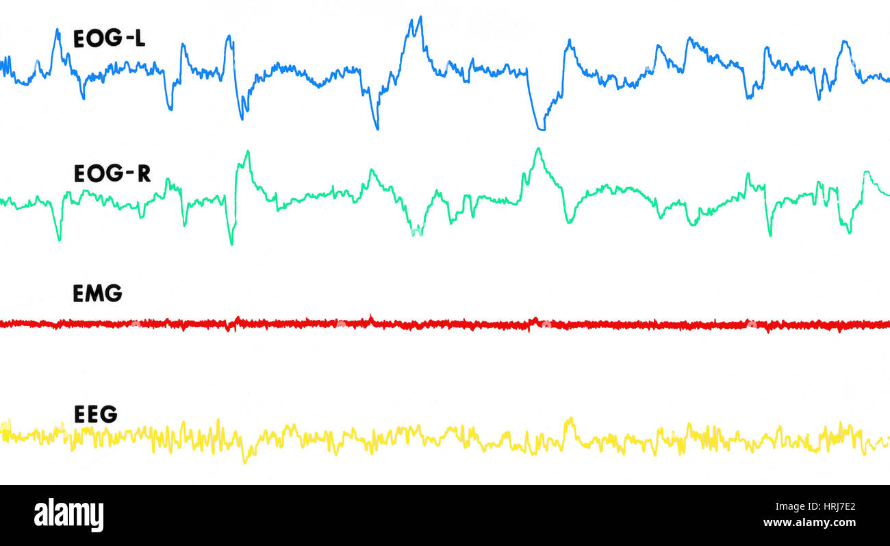 Polygraph Tracings of REM Sleep Stock Photo Alamy