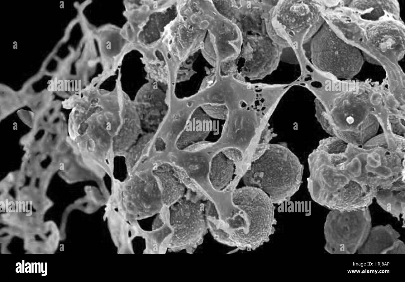 Multidrug resistant staphylococcus aureus hires stock photography and