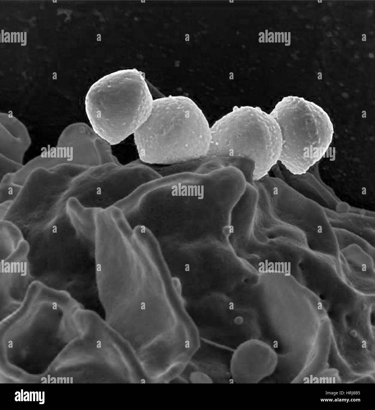 Streptococcus pyogenes Bacteria, SEM Stock Photo