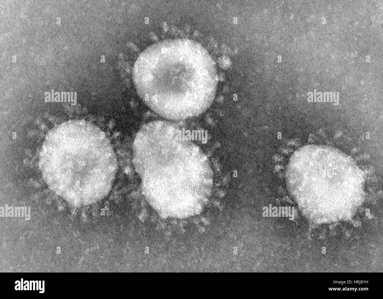SARS Coronavirus, EM Stock Photo Alamy
