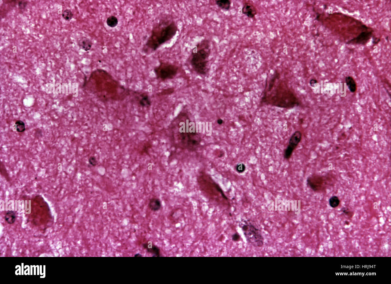 Rabies Virus, LM Stock Photo