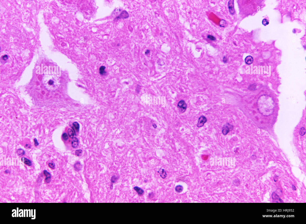 Rabies Virus, Negri Bodies, LM Stock Photo