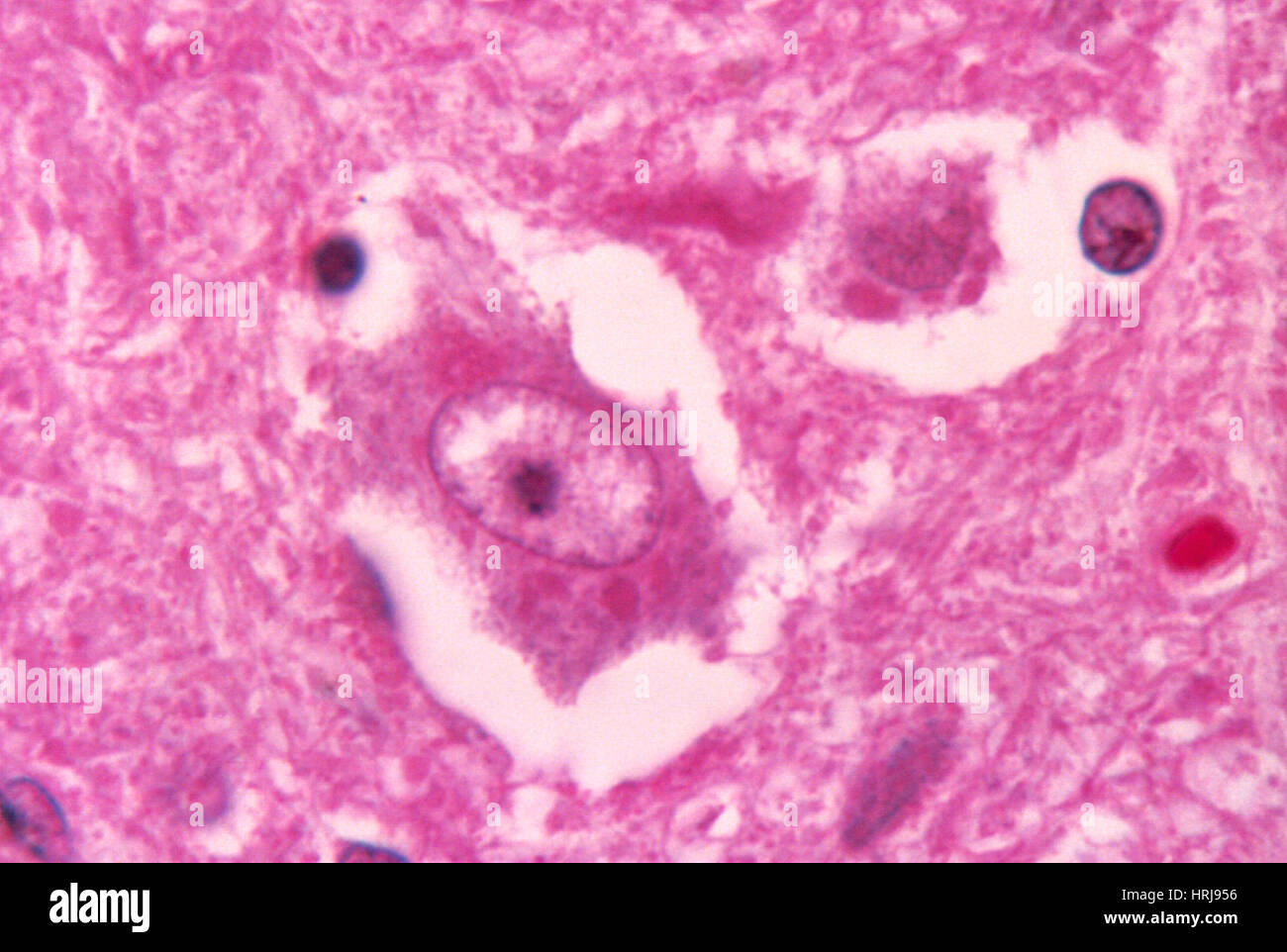 Rabies Virus, Negri Bodies, LM Stock Photo