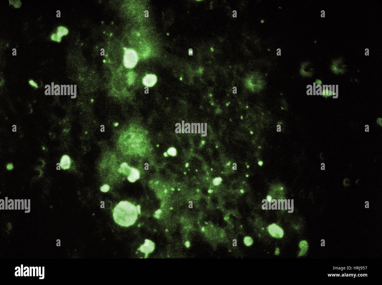 Rabies Virus, Immunofluorescent LM Stock Photo