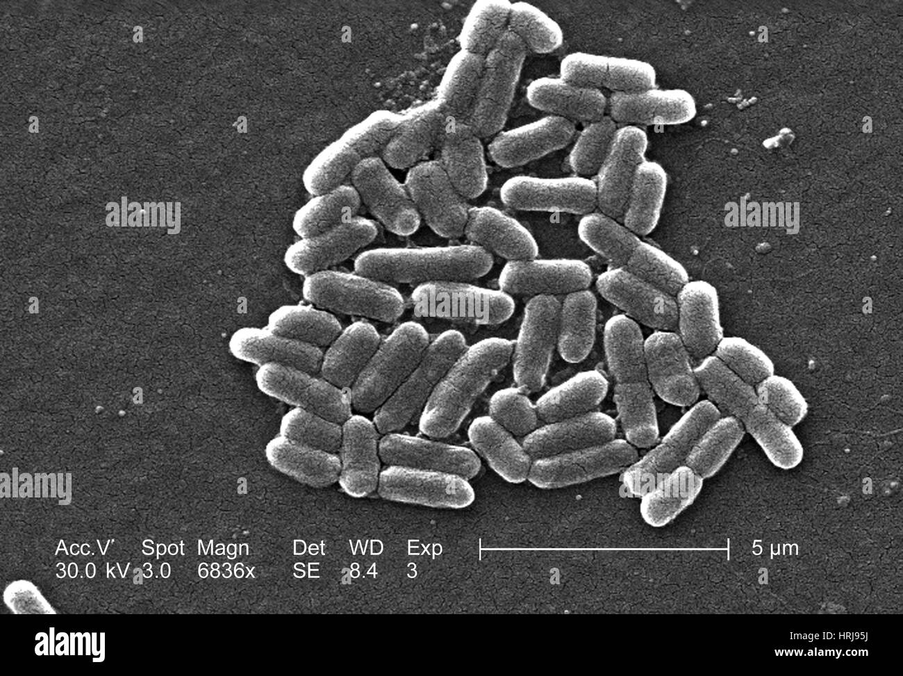 Escherichia coli O157:H7 Bacteria, SEM Stock Photo