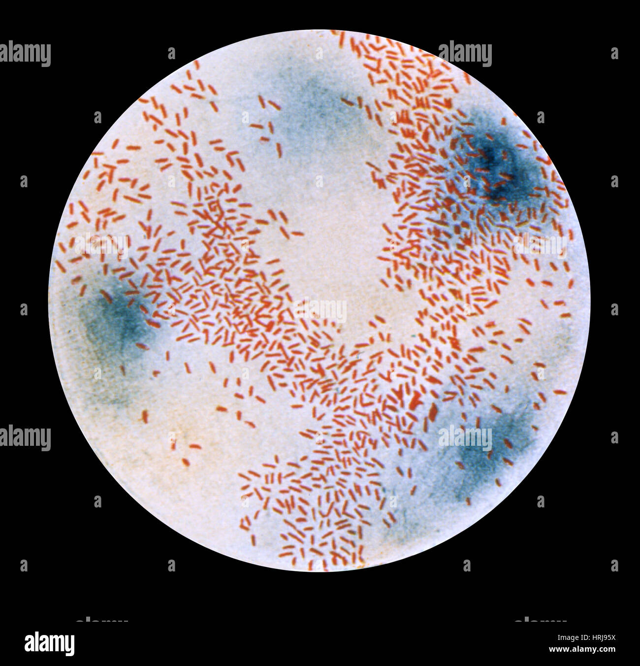 Haemophilus influenzae Bacteria, Gram-stain Technique, LM Stock Photo