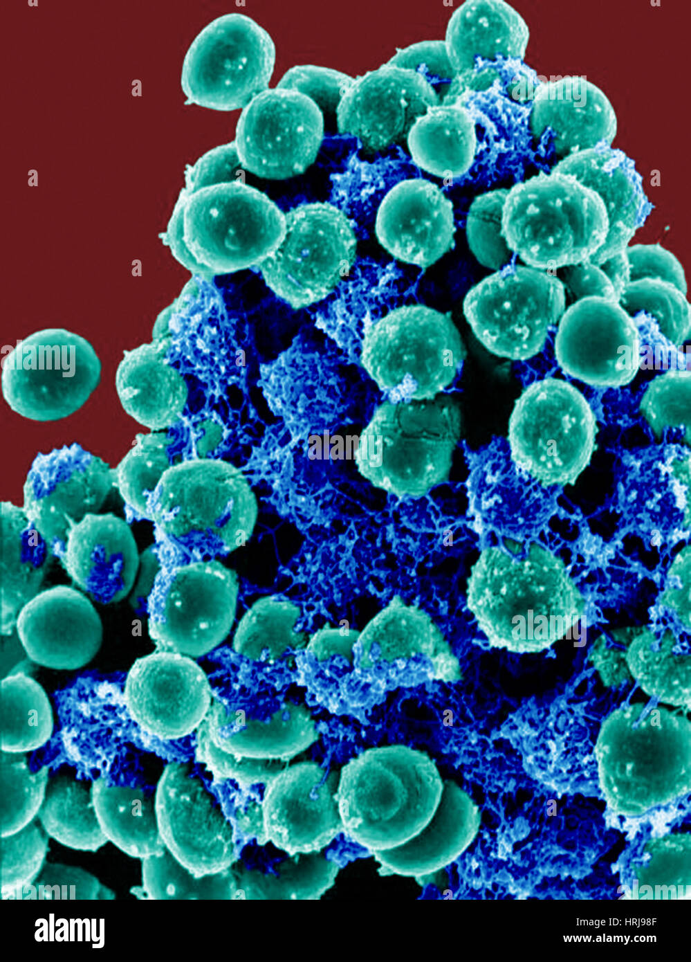 Staphylococcus epidermidis hi-res stock photography and images - Alamy