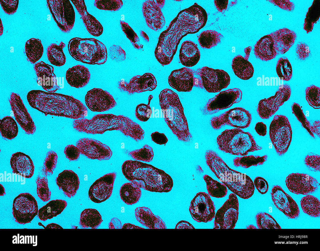 Coxiella burnetii патогенез. ку-лихорадка возбудитель. возбудитель ку-лихорадки эпидемиология. ку лихорадка микробиология. ку лихорадка патогенез.