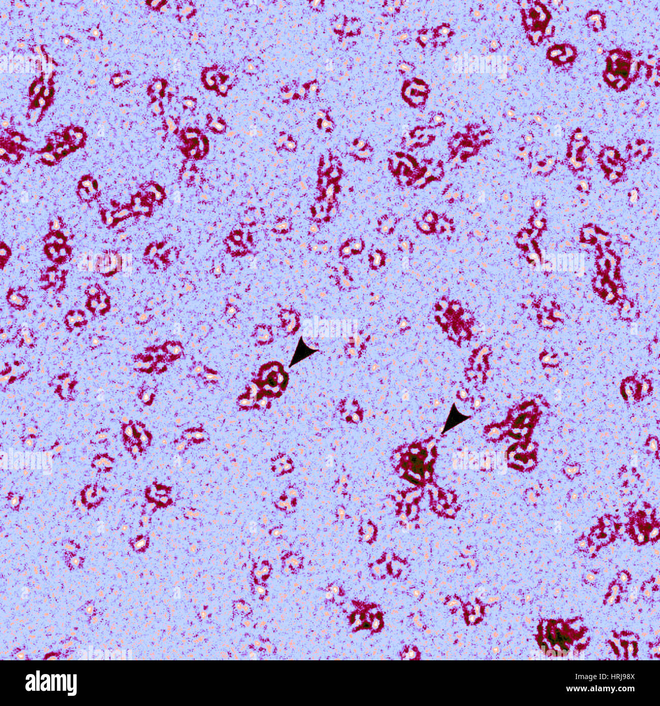 PmpD Protein, Chlamydia Trachomatis Bacteria, TEM Stock Photo