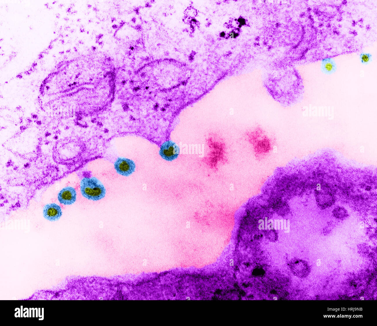 Rubella Virus, German Measles, TEM Stock Photo