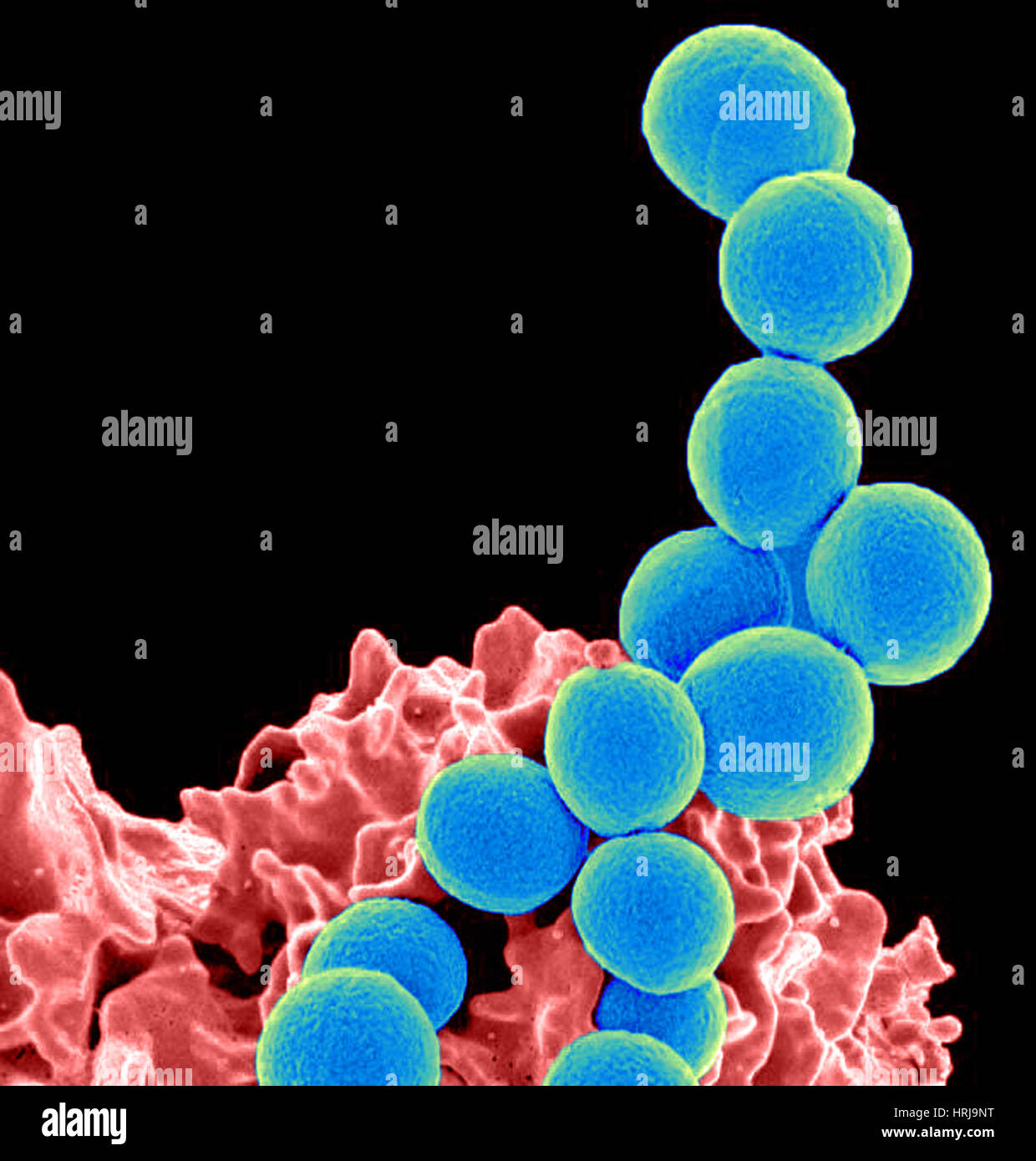 How Long Does Mrsa Live On A Dry Surface at Geneva Hammond blog