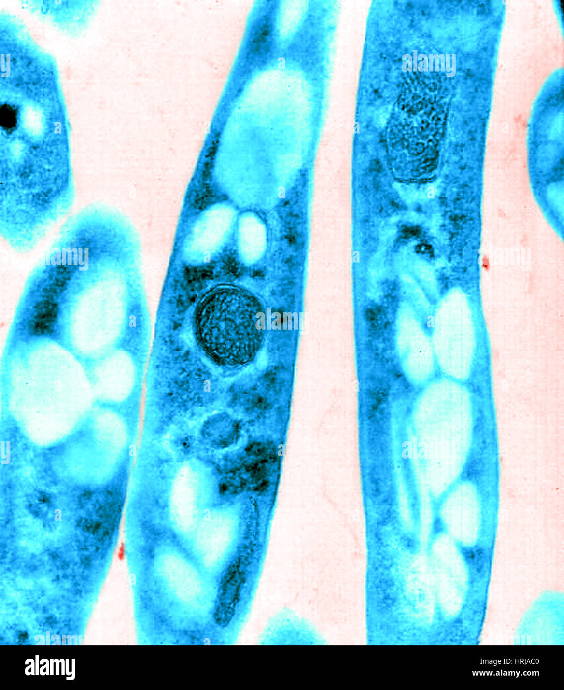 Anthrax, Bacillus anthracis Bacteria, TEM Stock Photo