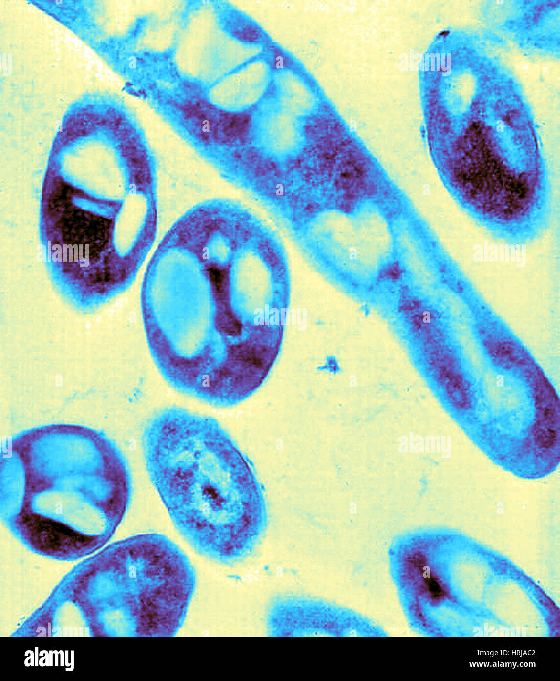 Anthrax, Bacillus anthracis Bacteria, TEM Stock Photo