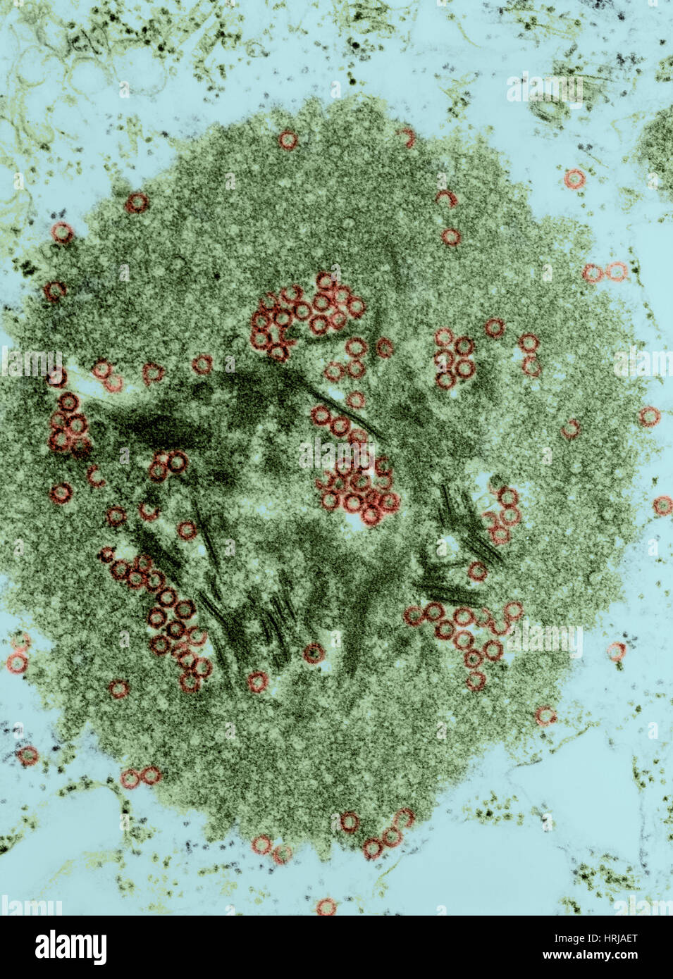 Tribec Virus, TEM Stock Photo