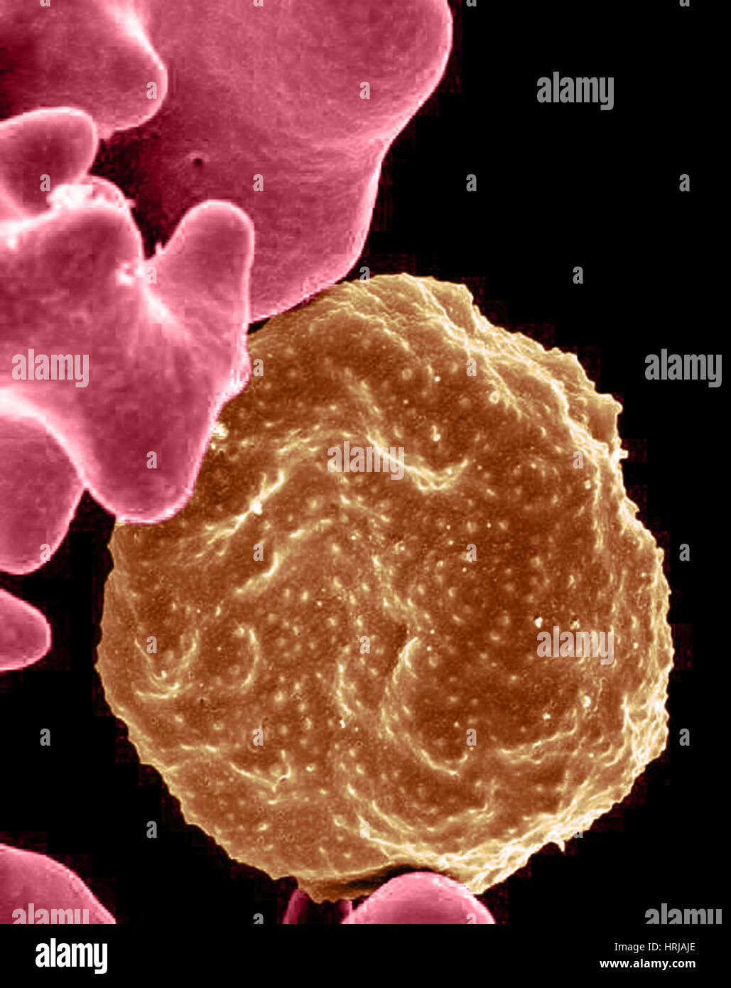 Malaria-infected Red Blood Cell, SEM Stock Photo
