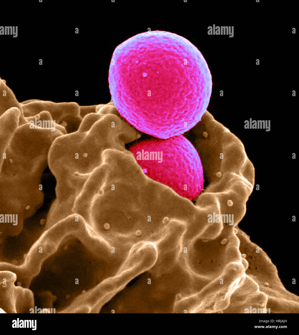 Neutrophil Ingesting MRSA bacteria, SEM Stock Photo