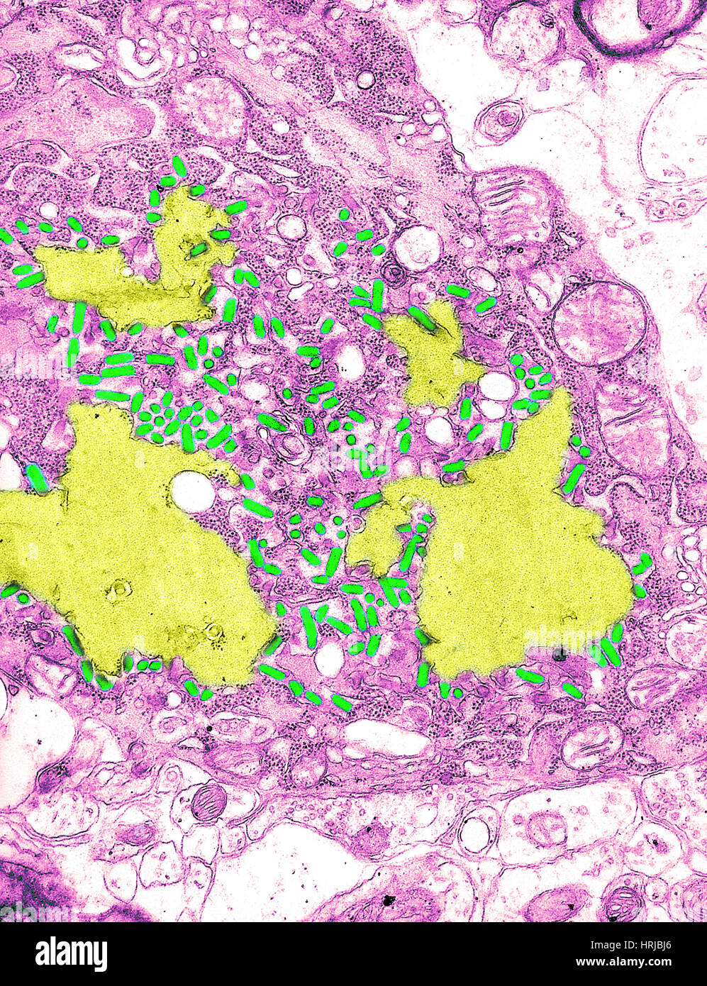 Rabies Virus, TEM Stock Photo