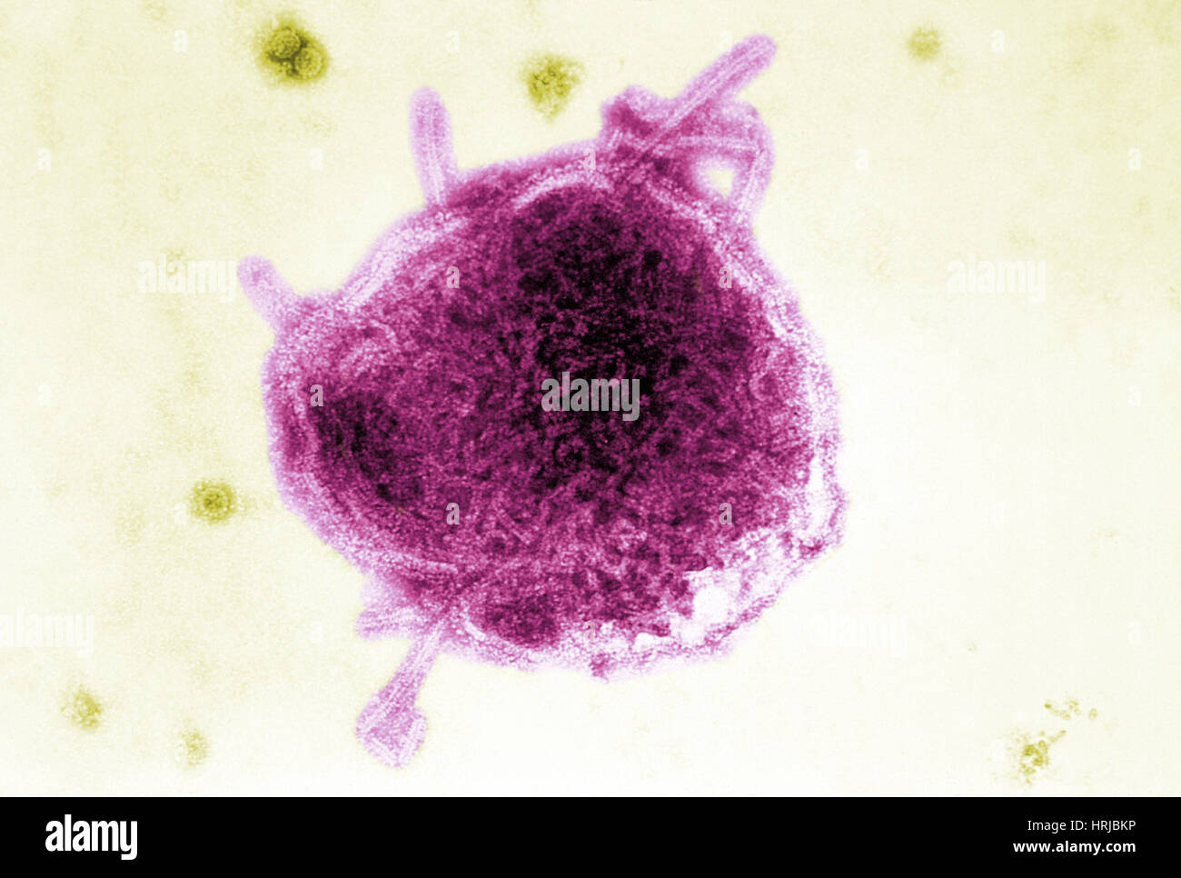 Measles and Simian Virus, TEM Stock Photo