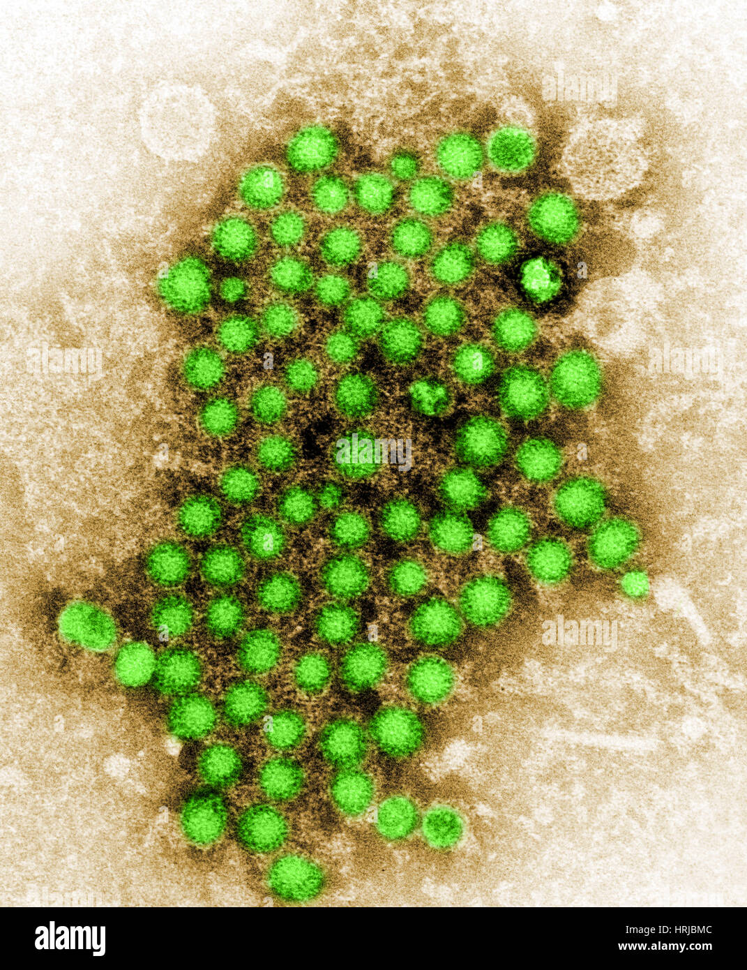 Hepatitis Virus, Unknown Strain, TEM Stock Photo