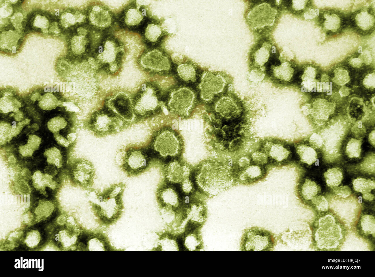 TEM of La Crosse Encephalitis Stock Photo Alamy