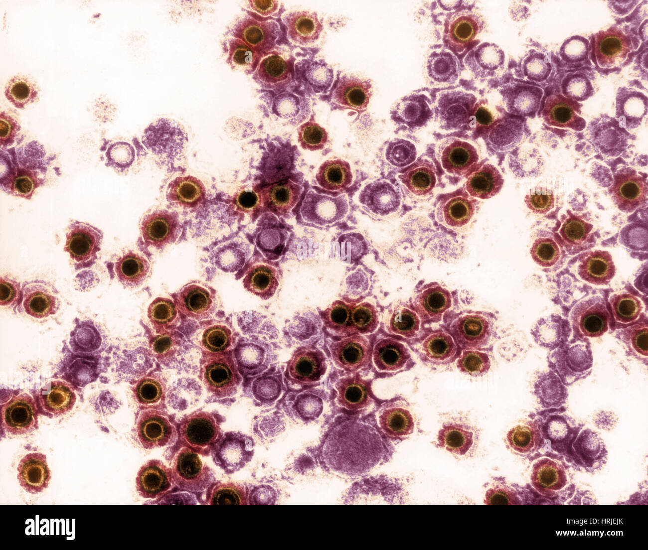 Herpes simplex, TEM Stock Photo