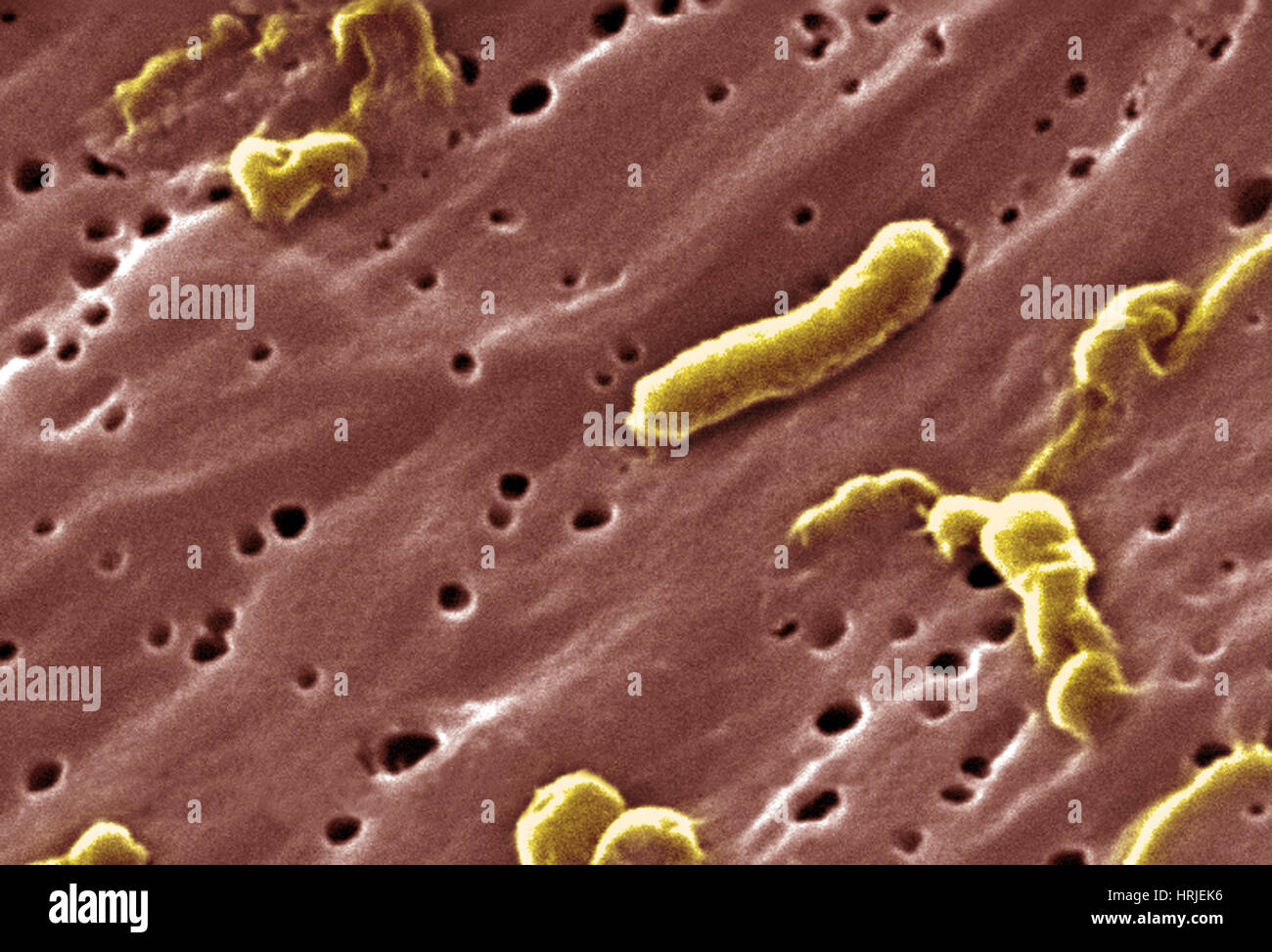 Vibrio cholerae Bacteria, SEM Stock Photo