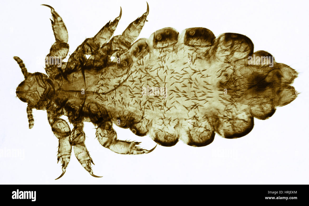 Human Louse, LM Stock Photo Alamy
