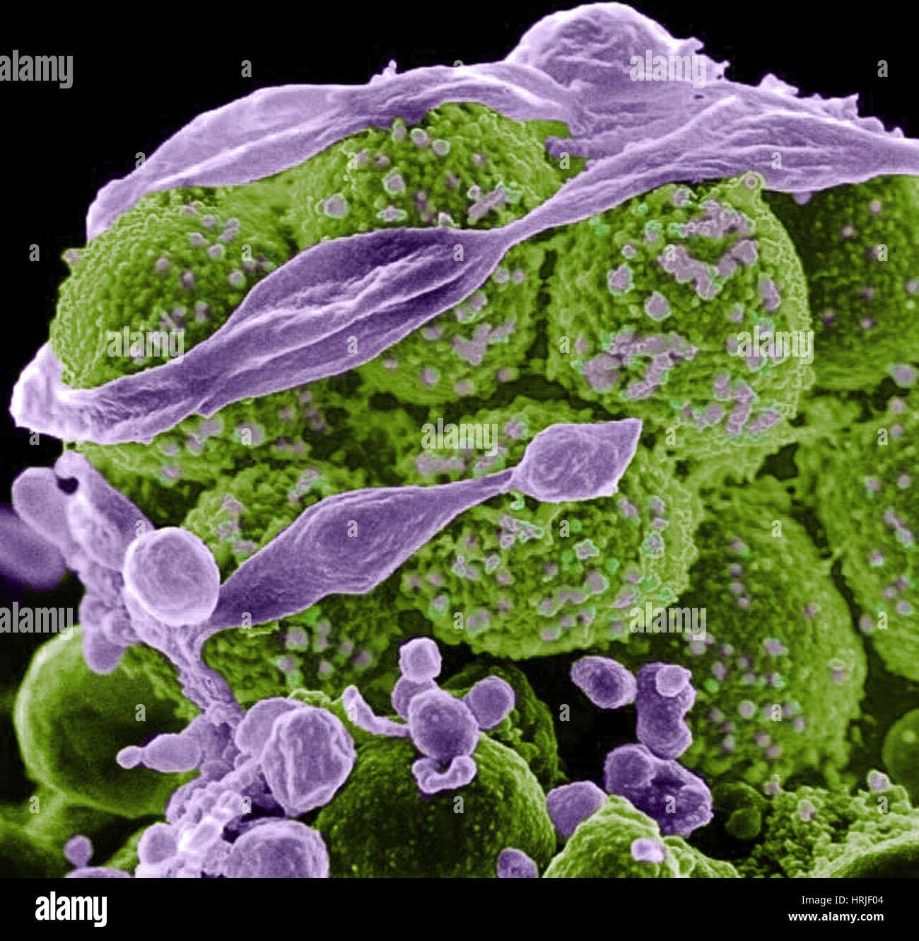 Staphylococcus aureus Bacteria, MRSA, SEM Stock Photo - Alamy