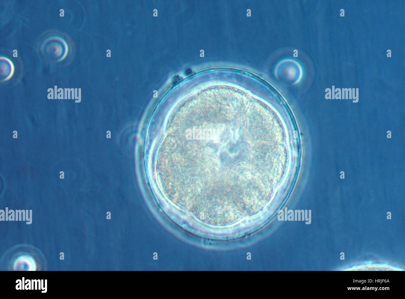 Embryo Development Urchin Hi Res Stock Photography And Images Alamy