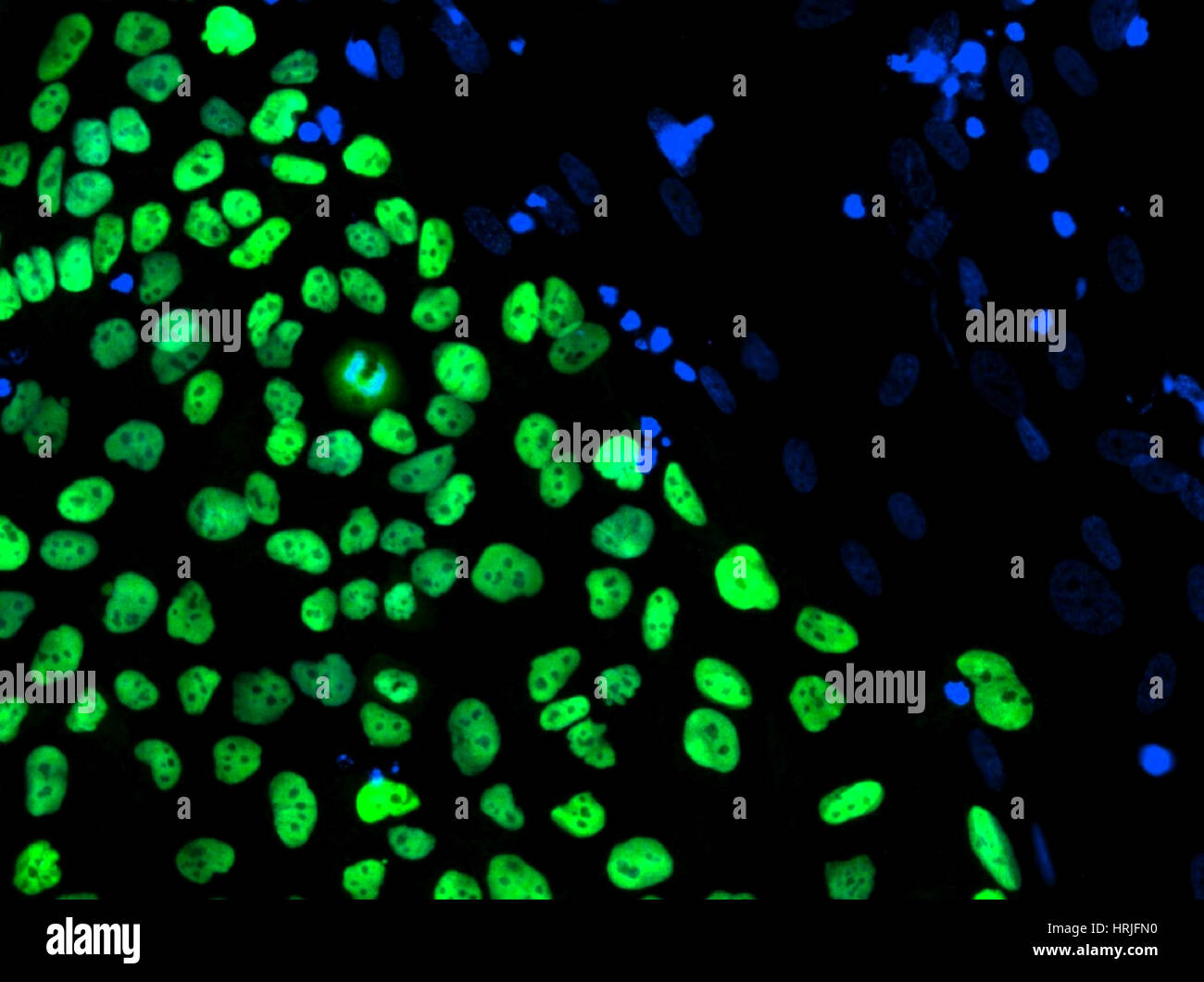 Human fibroblast cells hi-res stock photography and images - Alamy
