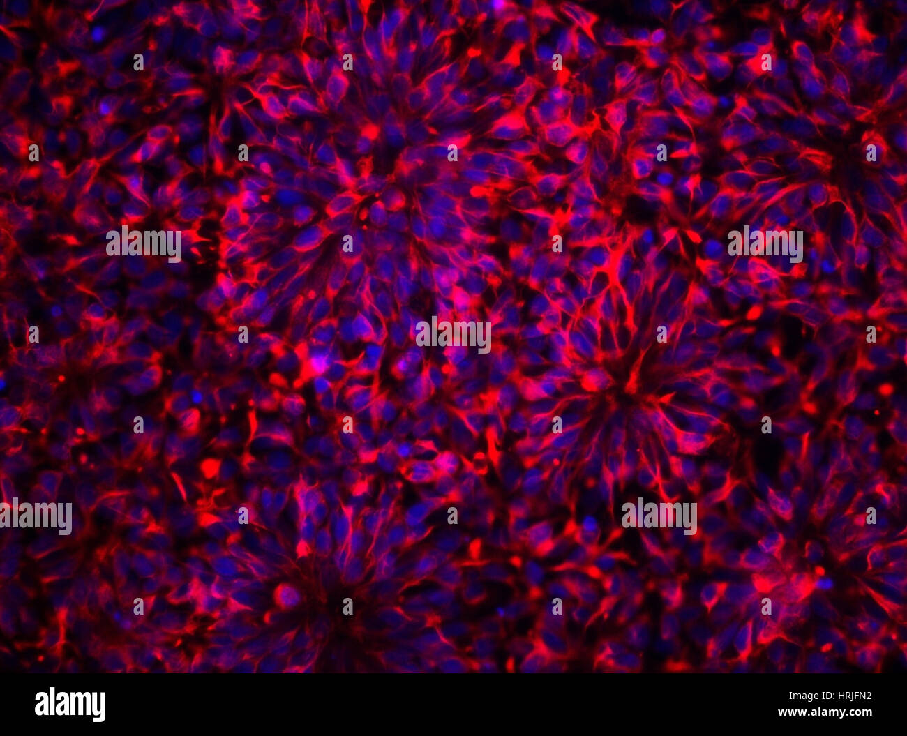 Human Embryonic Stem Cell Neurons, FM Stock Photo
