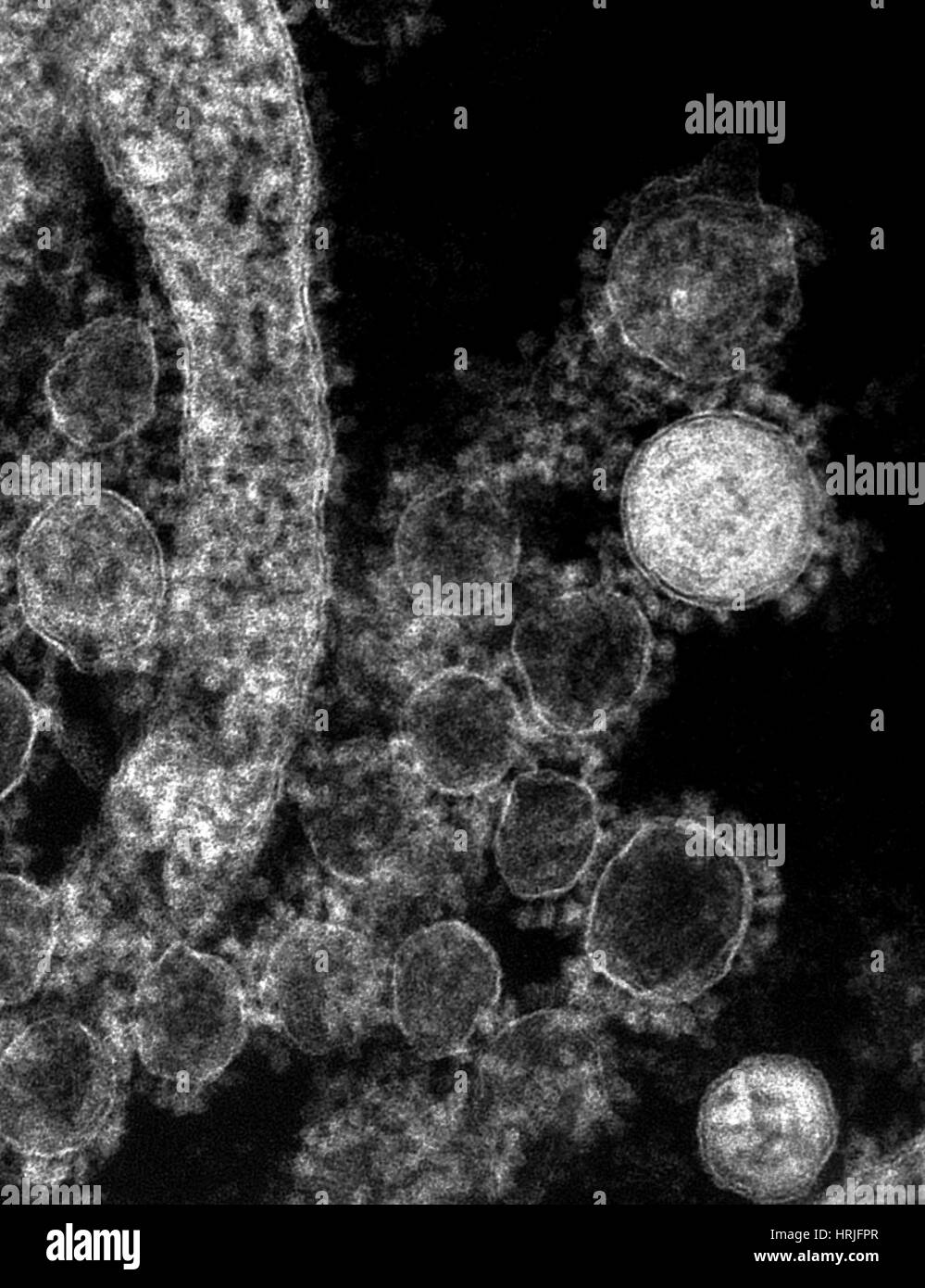 MERS-CoV, Betacoronavirus, TEM Stock Photo