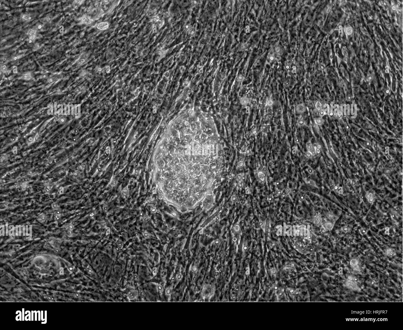 Human Embryonic Stem Cell Line BG01 Stock Photo